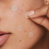 Your Bes-Tea BHA Spot Patches