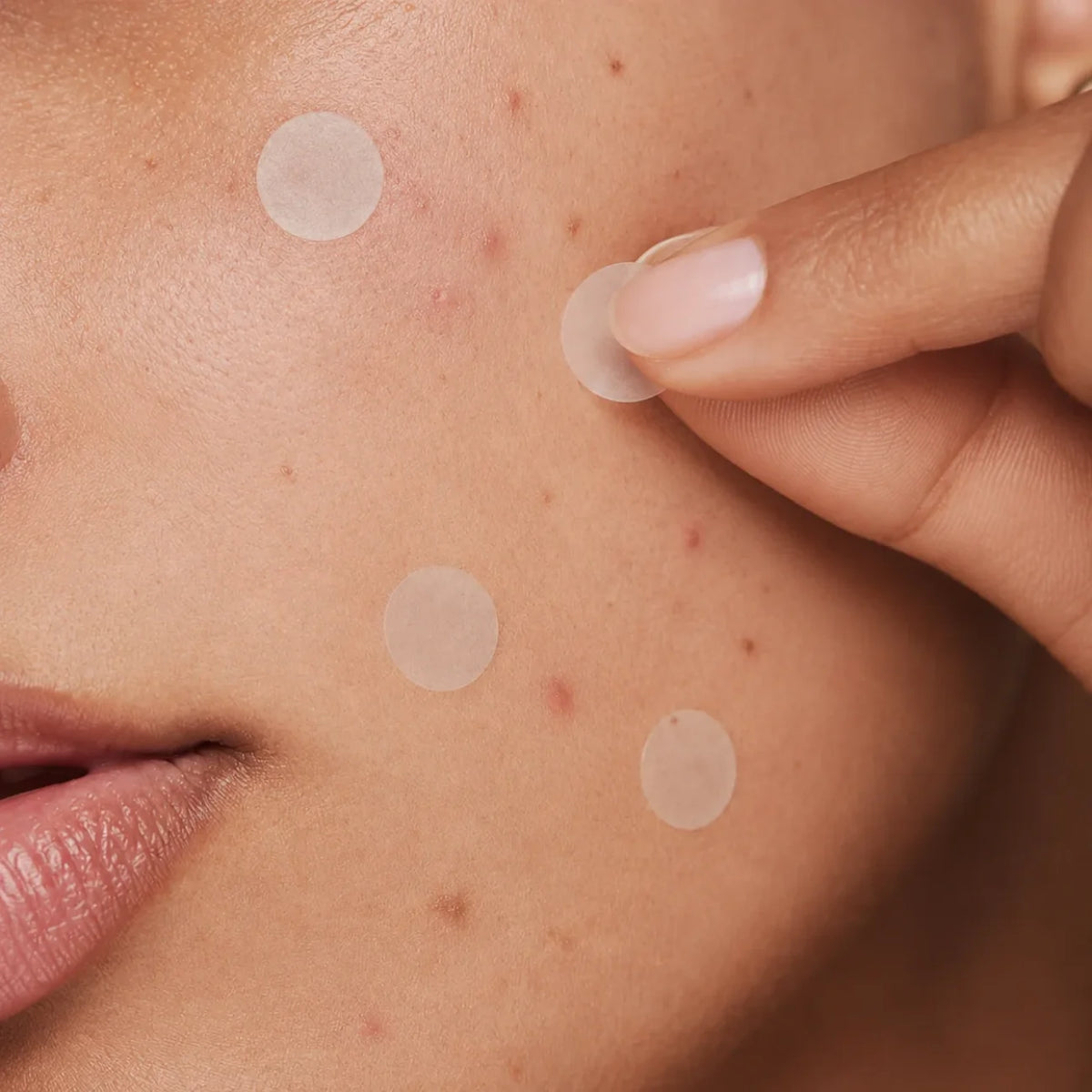 Your Bes-Tea BHA Spot Patches